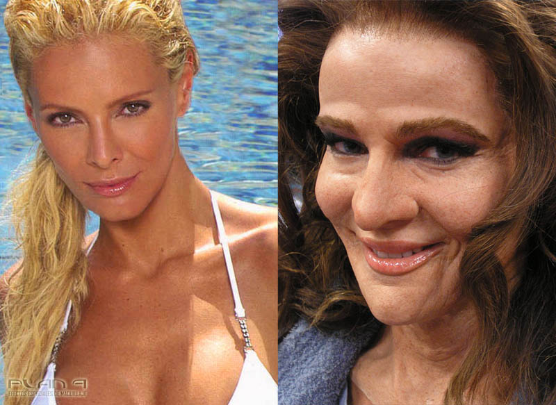 Before And After Celebrity Photos. But these celebrity fakeover